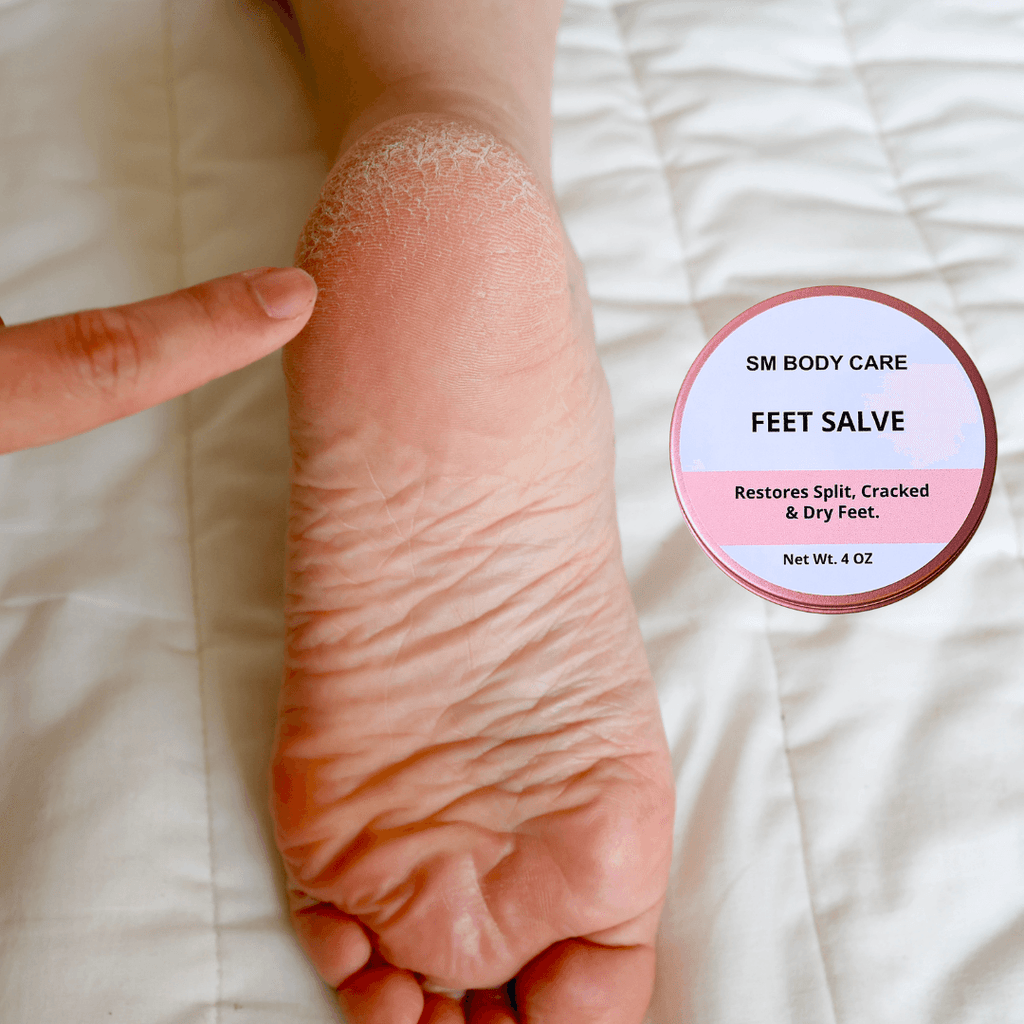  Soothing Balm- heel balm for cracked feet 